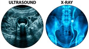 natomical comparison of ultrasound