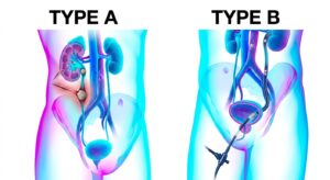 Comparison diagram showing two types of urological approa